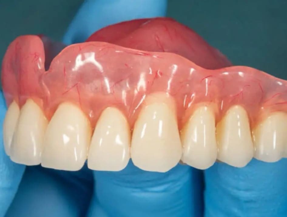 Profesionalios dantų techniko paslaugos Kaune🔹ilgametė patirtis